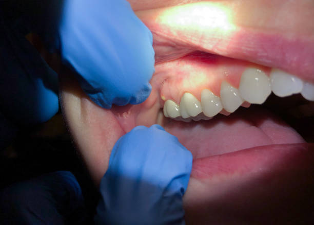 Best Emergency Dental Care for Trauma or Injury in South Fallsburg, NY